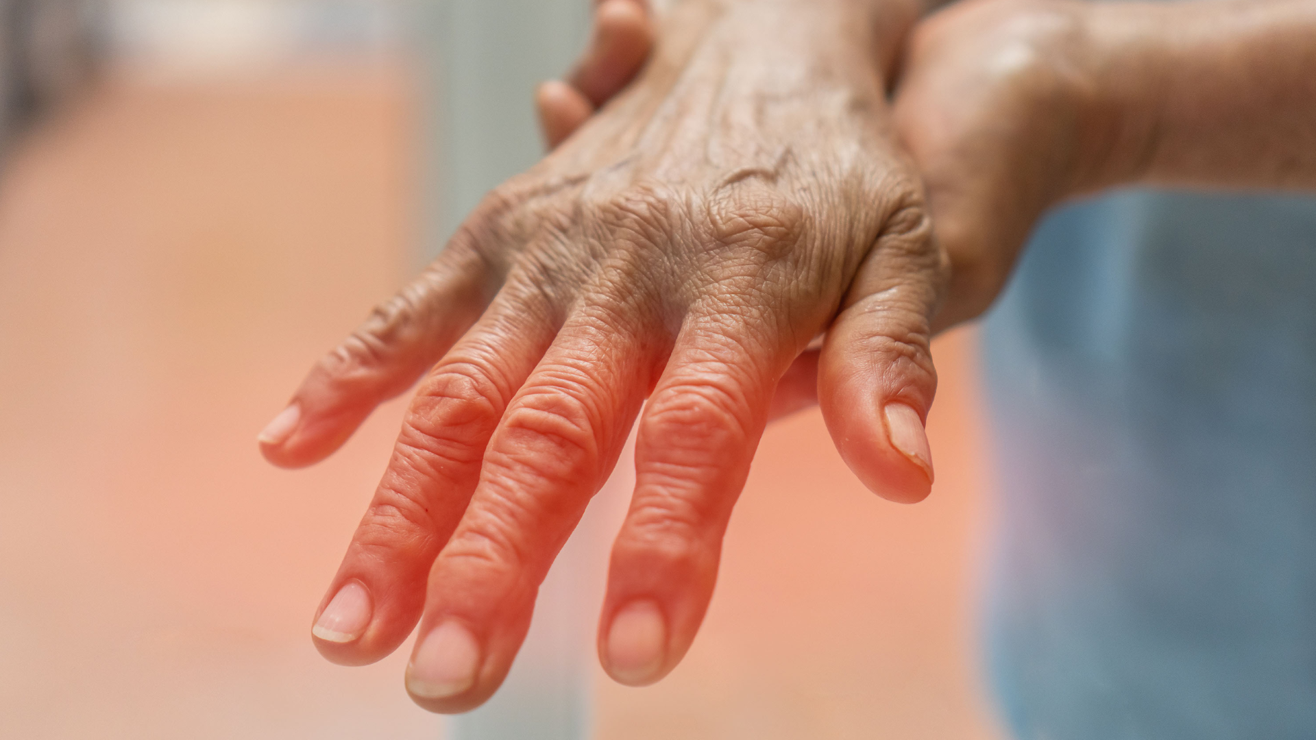 Read more about the article Athritis