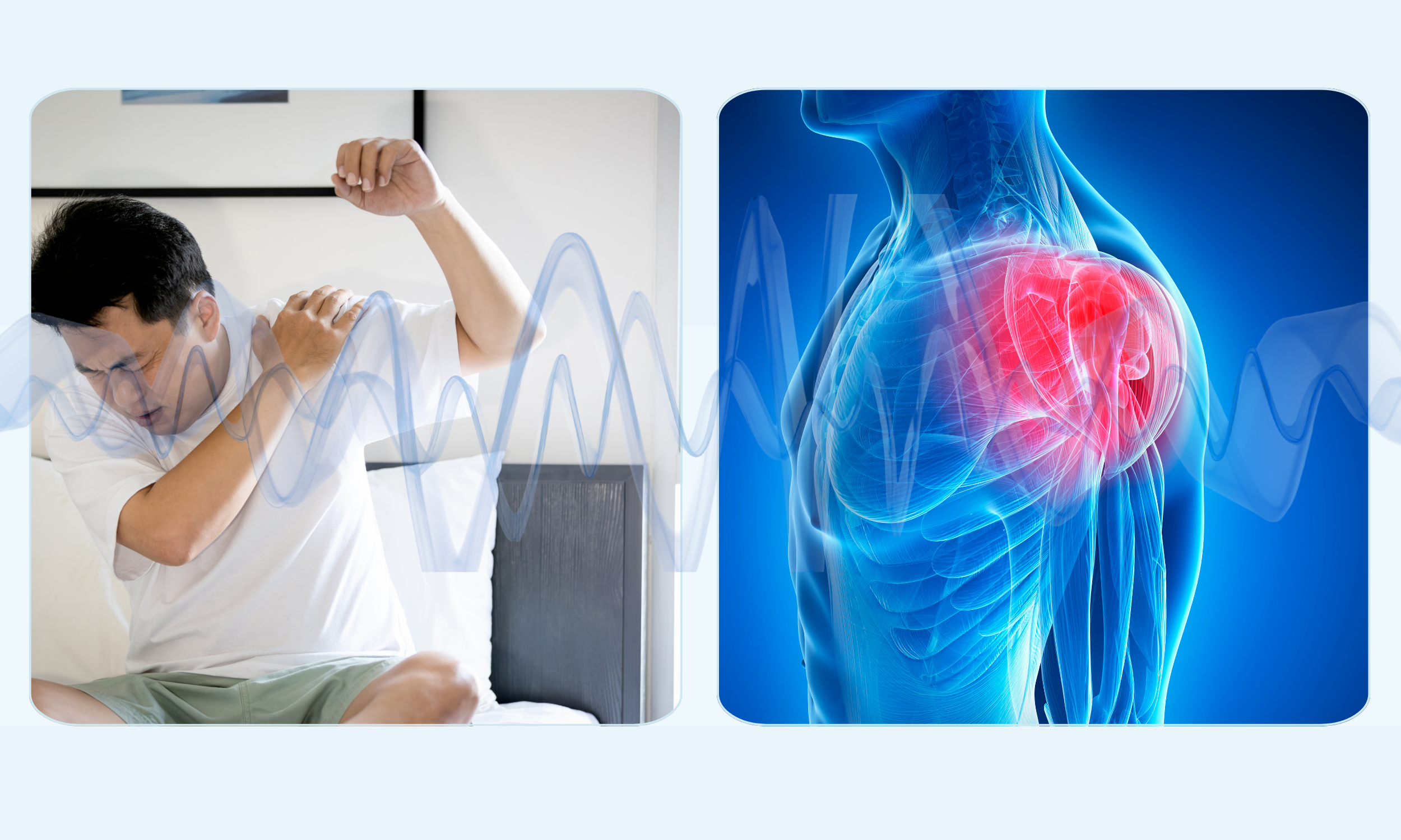 Read more about the article Treating Frozen Shoulder